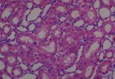 Hematoxylin & Eosin Stain: Rat organs perfusion fixation Tissue MicroArray (Normal) [NBP2-30228] -  40. Kidney, Medulla