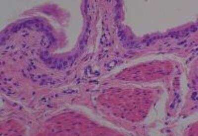 Hematoxylin & Eosin Stain: Rat organs perfusion fixation Tissue MicroArray (Normal) [NBP2-30228] -  41. Bladder