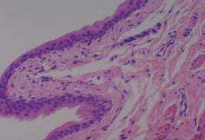 Hematoxylin & Eosin Stain: Rat organs perfusion fixation Tissue MicroArray (Normal) [NBP2-30228] -  42. Bladder