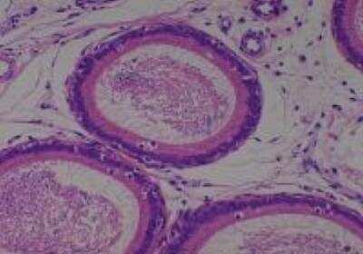 Hematoxylin & Eosin Stain: Rat organs perfusion fixation Tissue MicroArray (Normal) [NBP2-30228] - 44. Seminal vesicle