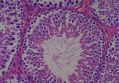 Hematoxylin & Eosin Stain: Rat organs perfusion fixation Tissue MicroArray (Normal) [NBP2-30228] -  45. Testis