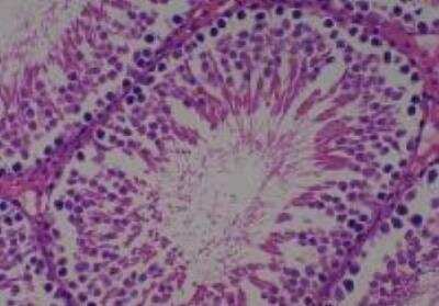 Hematoxylin & Eosin Stain: Rat organs perfusion fixation Tissue MicroArray (Normal) [NBP2-30228] -  46. Testis