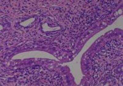 Hematoxylin & Eosin Stain: Rat organs perfusion fixation Tissue MicroArray (Normal) [NBP2-30228] -  47. Uterus