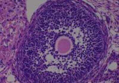 Hematoxylin & Eosin Stain: Rat organs perfusion fixation Tissue MicroArray (Normal) [NBP2-30228] - 48. Ovary