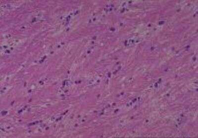 Hematoxylin & Eosin Stain: Rat organs perfusion fixation Tissue MicroArray (Normal) [NBP2-30228] - 53. Cerebrum