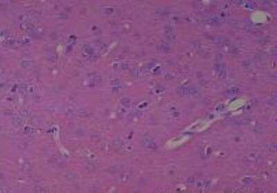 Hematoxylin & Eosin Stain: Rat organs perfusion fixation Tissue MicroArray (Normal) [NBP2-30228] -  54. Cerebrum