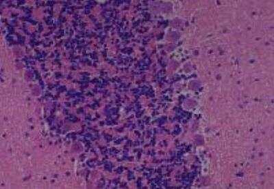 Hematoxylin & Eosin Stain: Rat organs perfusion fixation Tissue MicroArray (Normal) [NBP2-30228] - 57. Cerebellum