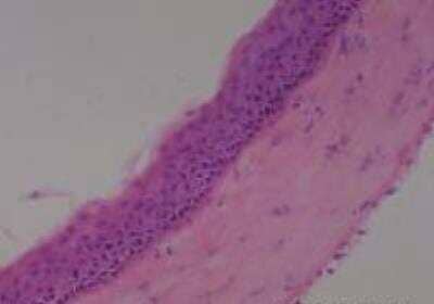 Hematoxylin & Eosin Stain: Rat organs perfusion fixation Tissue MicroArray (Normal) [NBP2-30228] - 59. Eyeball