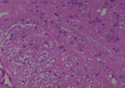 Hematoxylin & Eosin Stain: Rat organs perfusion fixation Tissue MicroArray (Normal) [NBP2-30228] - 58. Brain stem