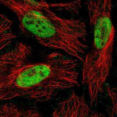 Immunocytochemistry/Immunofluorescence: RbAp46 Antibody [NBP2-46858] - Staining of human cell line HeLa shows localization to nucleoplasm.