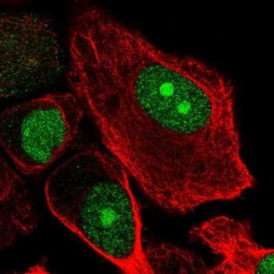 Immunocytochemistry/Immunofluorescence: RbBP5 Antibody [NBP2-55085] - Staining of human cell line PC-3 shows localization to nucleus & nucleoli.