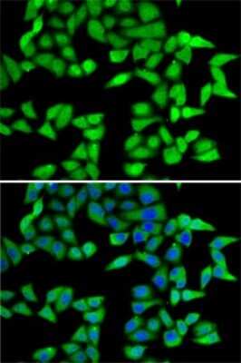 Immunocytochemistry/Immunofluorescence: RbBP5 Antibody [NBP2-95234] - Analysis of A-549 cells using RbBP5 . Blue: DAPI for nuclear staining.