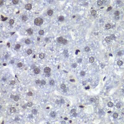 Immunohistochemistry-Paraffin: RbBP5 Antibody [NBP2-95234] -  Mouse liver using RBBP5 antibody  at dilution of 1:100 (40x lens).Perform microwave antigen retrieval with 10 mM PBS buffer pH 7.2 before commencing with IHC staining protocol.