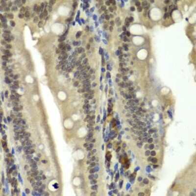 Immunohistochemistry-Paraffin: RbBP5 Antibody [NBP2-95234] -  Rat Intestine using RBBP5 antibody at dilution of 1:100 (40x lens).Perform microwave antigen retrieval with 10 mM PBS buffer pH 7.2 before commencing with IHC staining protocol.