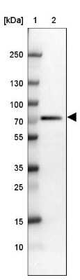 Western Blot RbBP5 Antibody