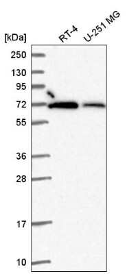 Western Blot: RbBP5 Antibody [NBP2-55085] - Western blot analysis in human cell line RT-4 and human cell line U-251 MG.