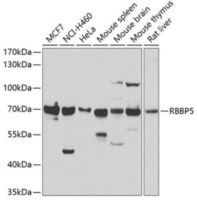 Western Blot RbBP5 Antibody - BSA Free