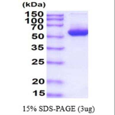 SDS-Page: Recombinant Bacterial Intein Protein [NBP2-22658] - Recombinant Bacteria Intein Protein [NBP2-22658] - 3ug by SDS-PAGE under reducing condition and visualized by coomassie blue stain