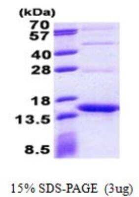 SDS-Page: Recombinant Bacterial Streptavidin Protein [NBP2-22641]