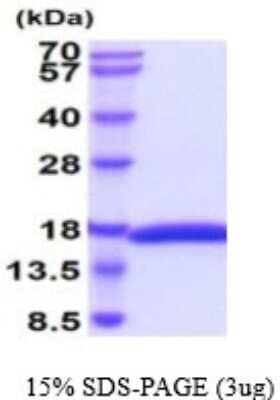 SDS-Page: Recombinant Canine IL-2 Protein [NBP2-59565] - 15% SDS-PAGE (3ug)