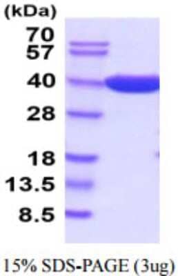 SDS-PAGE Recombinant E. coli beta-lactamase His Protein