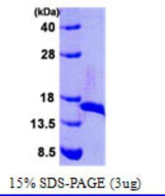SDS-Page: Recombinant E. coli DsbE Protein [NBC1-21275] - 15% SDS-PAGE (3ug)