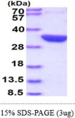 SDS-Page: Recombinant E. coli Glutaminase Protein [NBP1-72301] - 15% SDS-Page (3ug)