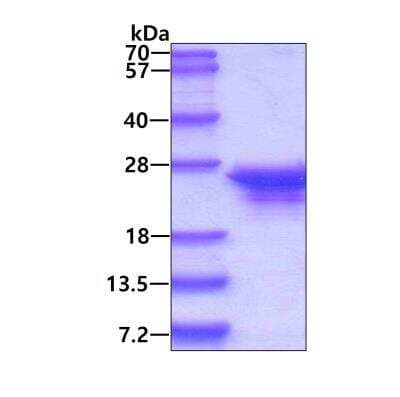 SDS-Page: Recombinant E. coli GrpE Protein [NBC1-18370] - 3ug by SDS-PAGE under reducing condition and visualized by coomassie blue stain.