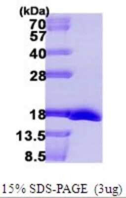 SDS-Page: Recombinant E. coli Methionine Sulfoxide Reductase B Protein [NBP1-72288] - 15% SDS-PAGE (3ug)