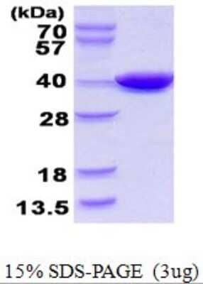 SDS-Page: Recombinant E. coli PANK1 Protein [NBP1-78894] - 15% SDS-PAGE (3ug)