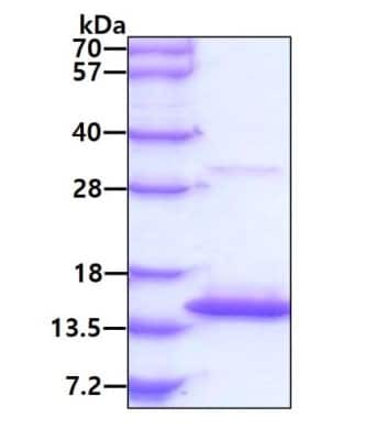 SDS-Page: Recombinant E. coli RNase P protein component Protein [NBP3-12867] - 3ug by SDS-PAGE under reducing condition and visualized by coomassie blue stain