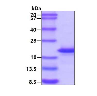 SDS-Page: Recombinant E. coli Ribonuclease Inhibitor Protein [NBP1-72417] - 3ug by SDS-PAGE under reducing condition and visualized by coomassie blue stain.