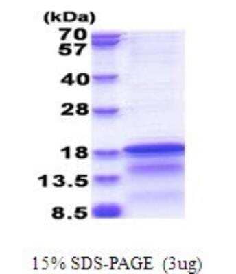 SDS-Page: Recombinant Virus HCV-Core Protein [NBP2-51778] -  15% SDS Page (3 ug)