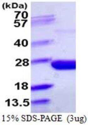 SDS-Page: Recombinant E. coli Inorganic Pyrophosphatase/PPA1 Protein [NBP1-72378] - 15% SDS-PAGE (3ug)