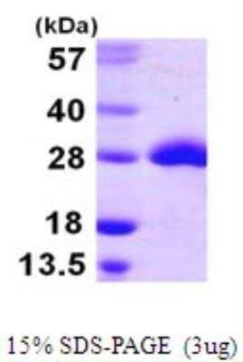 SDS-Page: Recombinant E. coli Methionine Sulfoxide Reductase A Protein [NBP1-72289] - 15% SDS-PAGE (3ug)