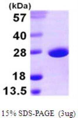 SDS-Page: Recombinant E. coli SOD1/Cu-Zn SOD Protein [NBP1-72290] - 15% SDS-PAGE (3ug)