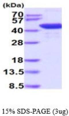 SDS-Page: Recombinant Mouse Histone Deacetylase 8/HDAC8 Protein [NBP2-59518] - 15% SDS-PAGE (3ug)