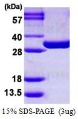 SDS-Page: Recombinant Mouse PGAM1 Protein [NBP1-99029] - 15% SDS-PAGE (3ug)