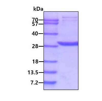 SDS-PAGE Recombinant Human 14-3-3 beta/alpha Protein