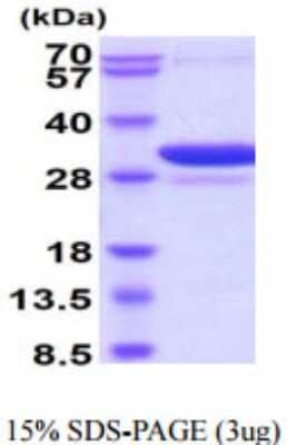 SDS-PAGE Recombinant Human 14-3-3 beta/alpha His Protein