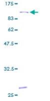 SDS-PAGE Recombinant Human 15-Lipoxygenase 1 GST (N-Term) Protein