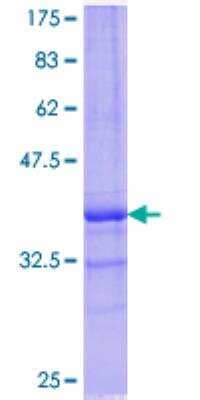 SDS-Page: Recombinant Human 15-Lipoxygenase 2 Protein [H00000247-Q01] - 12.5% SDS-PAGE Stained with Coomassie Blue.