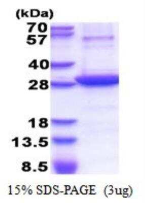 SDS-Page: Recombinant Human 5'-Nucleotidase/CD73 Protein [NBP2-51548] -  15% SDS Page (3 ug)