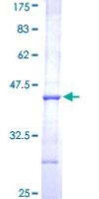 SDS-PAGE Recombinant Human AADAC GST (N-Term) Protein