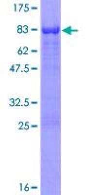 SDS-PAGE Recombinant Human AAK1 GST (N-Term) Protein