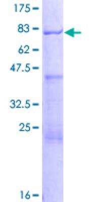 SDS-Page: Recombinant Human AAMP Protein [H00000014-P01] - 12.5% SDS-PAGE Stained with Coomassie Blue.