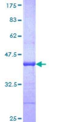 SDS-Page: Recombinant Human ABCA4 Protein [H00000024-Q01] - 12.5% SDS-PAGE Stained with Coomassie Blue.