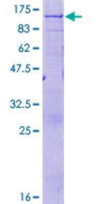 SDS-Page: Recombinant Human ABCD1 Protein [H00000215-P01] - 12.5% SDS-PAGE Stained with Coomassie Blue.