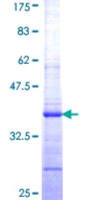 SDS-Page: Recombinant Human ABCD1 Protein [H00000215-Q01] - 12.5% SDS-PAGE Stained with Coomassie Blue.