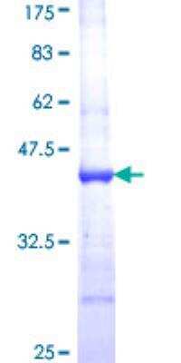SDS-Page: Recombinant Human ABCF1 Protein [H00000023-Q01] - 12.5% SDS-PAGE Stained with Coomassie Blue.